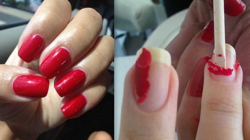 Tratează Unghiile Deteriorate De Acoperirea Cu Gel Sau Shellac Prin