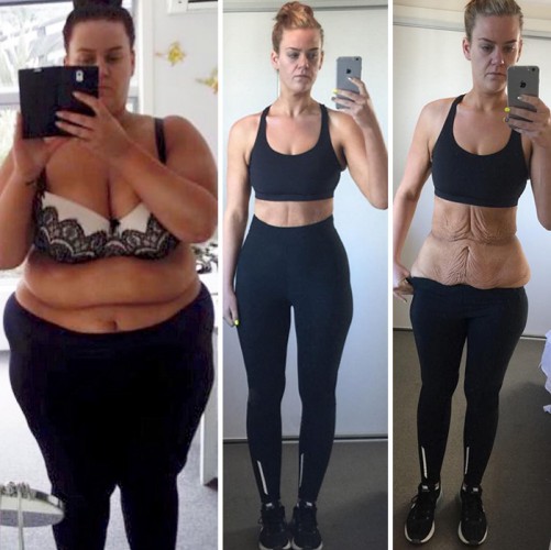 înainte și după pierderea în greutate poze