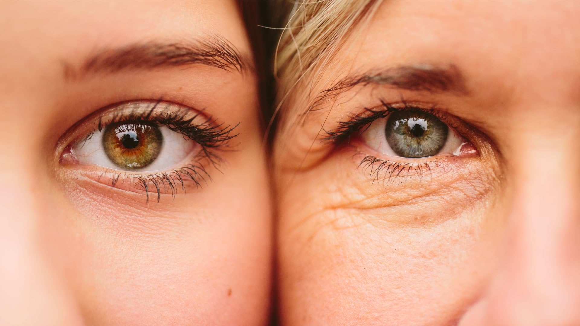 Cum să previi apariția ridurilor în jurul ochilor